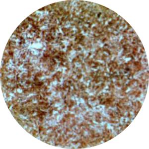 Application Alveolar epithelial cells (AEC)