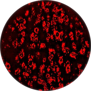 Application MCMV (Murine Cytomegalovirus) red fluoro remission.