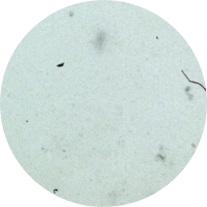 Application Foci assay: total well view