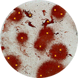 Application Foci assay: Very large Foci